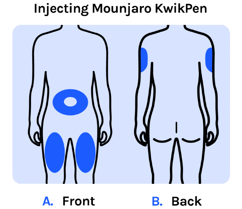 Best Mounjaro Injection Sites For Your Weekly Dose